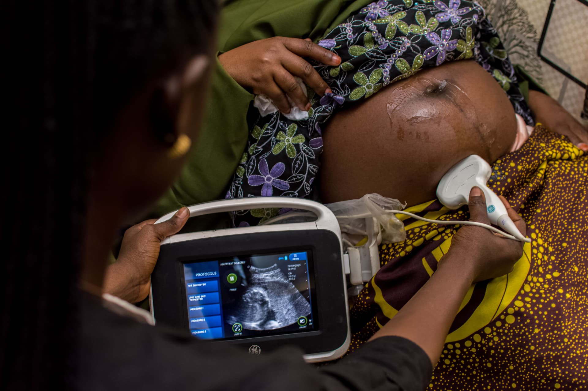 Ultrasound services at Excel Scan Services